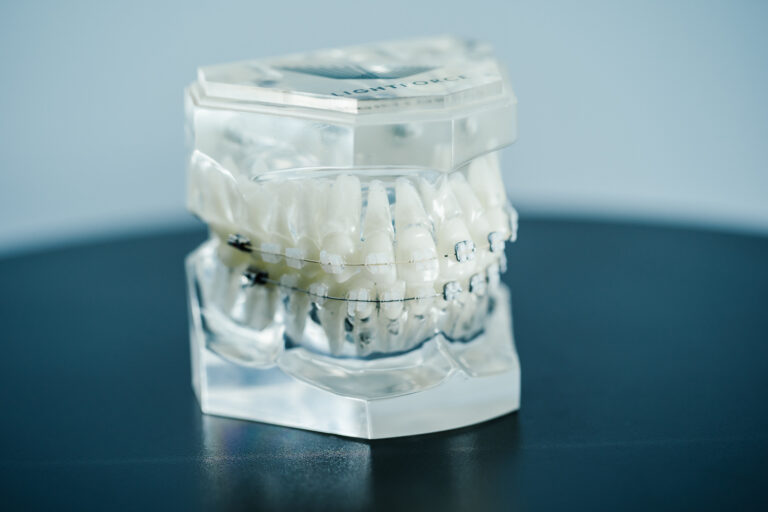hillsborough nc clear braces