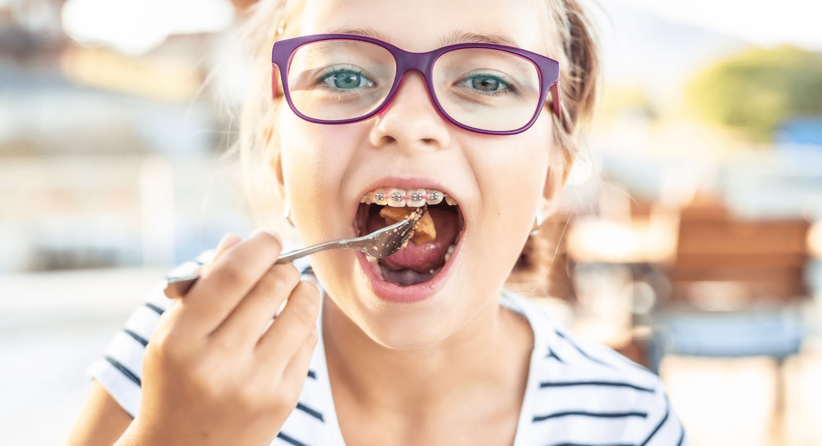 What to Eat With Braces