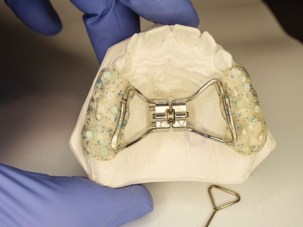 What Are Interceptive Orthodontics?